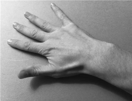 Illustration 12 for Master Hands and Paediatric Orthopaedics: Diagnose & Treat