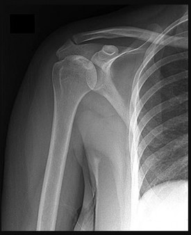 Orthopedic Surgery Mock Exam - Set 00C4AD