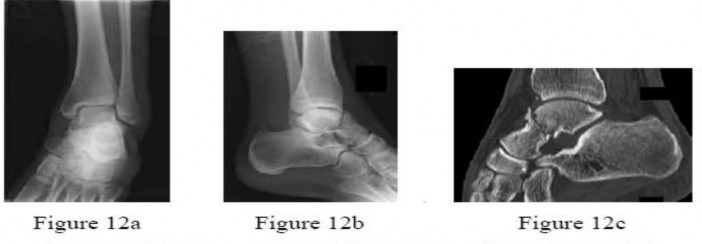 Orthopedic Trauma Review | Dr Hutaif Trauma & Fractures -...