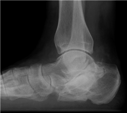 Illustration 12 for First Metatarsal Surgery: Expert Solutions for Foot & Ankle Pain