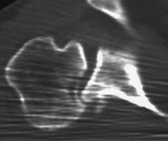 Illustration 41 for Acad Orthop Surg Challenge: Diagnose Shoulder Pain Case 1