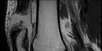 3 Sports Medicine Cases: What You're Able to Get from Patient Data