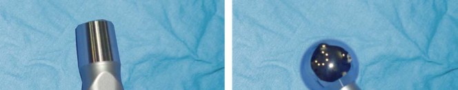 صورة طبية: مفصل الفخذ الصناعي قصير الجذع METHA: حلول مبتكرة للحفاظ على العظم في صنعاء مع الأستاذ الدكتور محمد هطيف