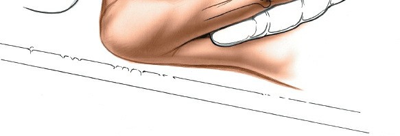 Illustration 42 for Mastering Approaches to the Upper Third of the Radius
