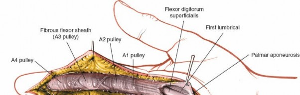 Illustration 149 for Essential Surgical Approaches: Uncover Every Aspect of the Wrist