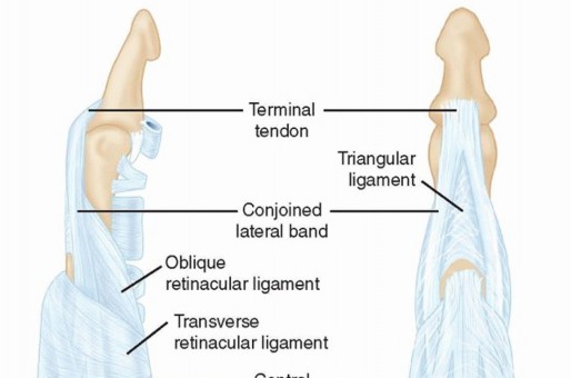 Proximal Interphalangeal and Metacarpophalangeal Joint Surface Replacement Arthroplasty