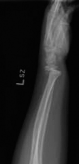Illustration 5 for Pediatric Orthopedic Cases: Diagnose & Treat a Child's Wrist Fracture