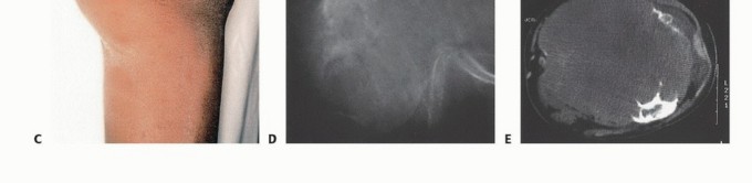 وصف طبي دقيق للمريض