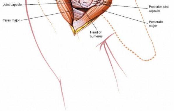 Illustration 41 for Essential Guide: Mastering Every Approach to the Shoulder