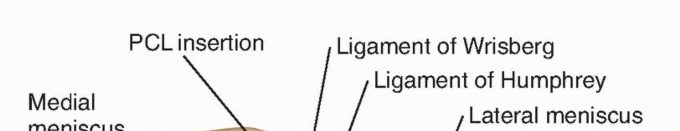 Demystifying the Modified Gillquist Maneuver in Knee Arthroscopy