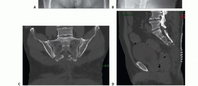 صورة طبية: جراحة أورام العجز: الحفاظ على وظائف الأمعاء والمثانة مع الأستاذ الدكتور محمد هطيف في صنعاء