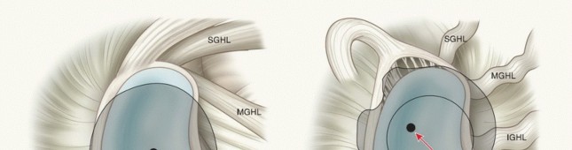Throwing Shoulder Pain? Optimize Your Late Cocking Phase Mechanics