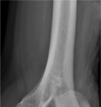 Illustration 42 for Solve Shoulder & Elbow Cases: When a Patient Presents to Clinic