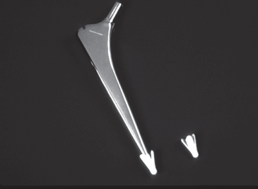 Illustration of metal on metal - Dr. Mohammed Hutaif