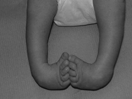 Illustration 20 for Master Hands and Paediatric Orthopaedics: Diagnose & Treat