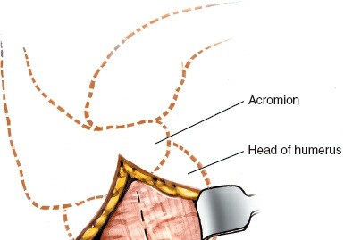 Illustration 103 for Essential Guide: Mastering Every Approach to the Shoulder