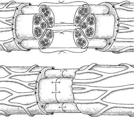 Illustration 5 for Decoding Von Willebrand Factor: Fundamental Basic Science Principles