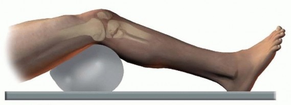 Understanding Lateral Tibial Plateau Fractures: Expert Insights