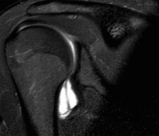 Shoulder Instability Cases: Interactive Diagnosis Challenge