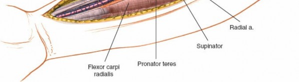 Illustration 10 for Mastering Approaches to the Upper Third of the Radius