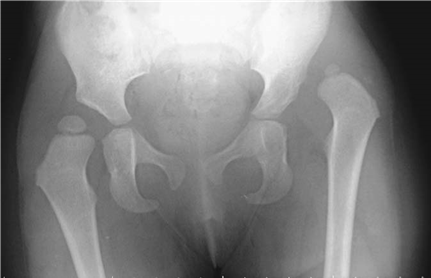 Illustration 15 for Master Hands and Paediatric Orthopaedics: Diagnose & Treat