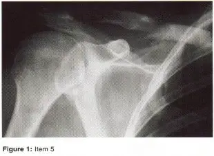 صورة توضيحية لـ دليلك الشامل لأمراض وإصابات العظام والمفاصل في اليمن: خبرة الأستاذ الدكتور محمد هطيف في صنعاء