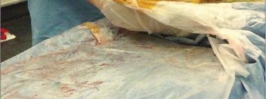 Illustration 26 for Mastering Soft Tissue Balancing for Optimal THR Outcomes