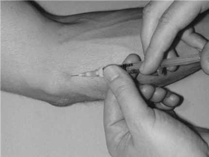 Illustration 26 for Ace FRCS Orthopaedics: Oxford University Press Adult Pathology Viva