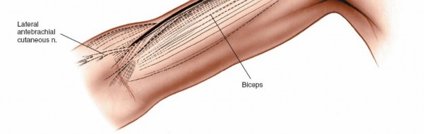 Illustration 3 for Humeral Shaft Anterior Approach: Master Surgical Techniques
