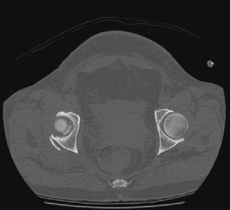 Illustration 2 for Lower Limb Trauma: Master Urgent Management & Ace Your Exams