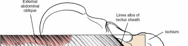 Mastering the Rectus Abdominis Muscle in Lumbar Anterior Approach