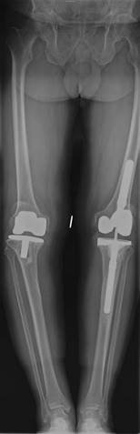 Illustration 9 for Ace FRCS Orthopaedics: Oxford University Press Adult Pathology Viva