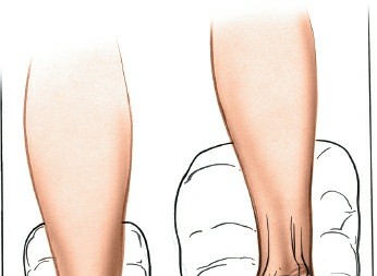 Posterolateral Ankle Approach: Mastering the Hallucis Longus Muscle