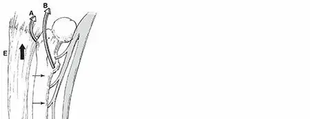 صورة توضيحية لـ كسور عظم الفخذ: دليل شامل للمرضى نحو التعافي التام مع الأستاذ الدكتور محمد هطيف