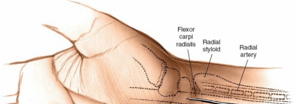 Illustration 51 for Essential Surgical Approaches: Uncover Every Aspect of the Wrist