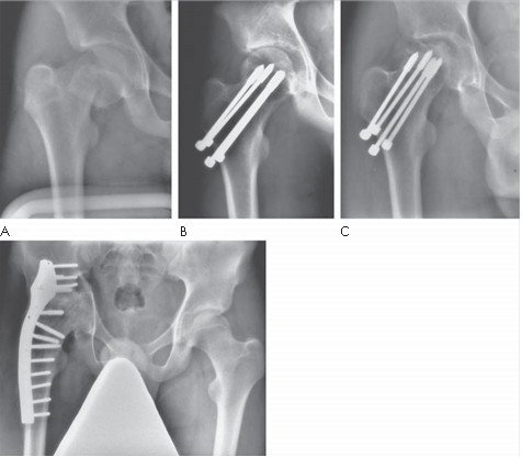 Illustration 15 for Ace FRCS Orthopaedics: Oxford University Press Adult Pathology Viva