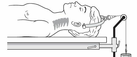 General Cervical Treatment: Essential Spine Care & Options