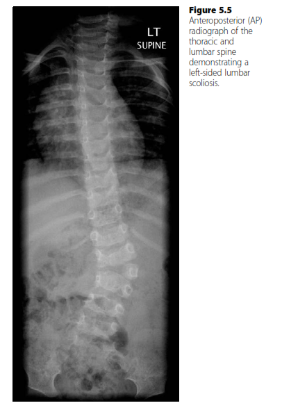 Scoliosis Examination Question: Master Your Oral Exam