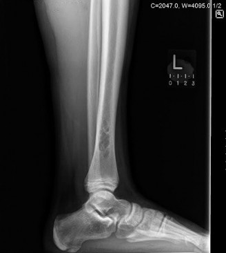 Illustration of oncology cases nof - Dr. Mohammed Hutaif