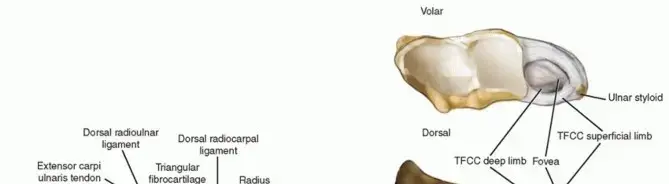 صورة توضيحية لـ جراحة تقصير الزند: حلول نهائية لآلام الرسغ المزمنة مع الأستاذ الدكتور محمد هطيف
