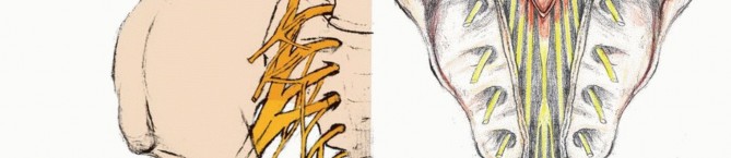 صورة توضيحية لـ جراحة أورام العجز: الحفاظ على وظائف الأمعاء والمثانة مع الأستاذ الدكتور محمد هطيف في صنعاء