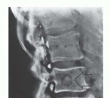 Clinical Image