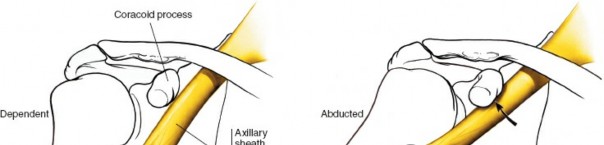 Illustration 24 for Essential Guide: Mastering Every Approach to the Shoulder
