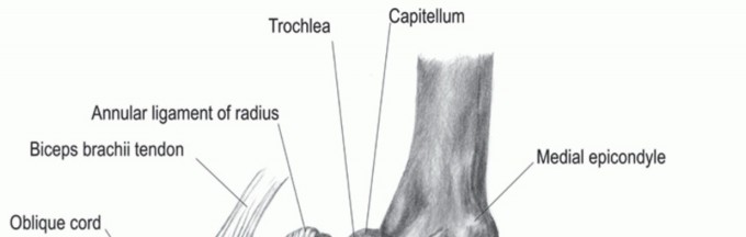 Illustration of ulnar collateral ligament reconstruction - Dr. Mohammed Hutaif