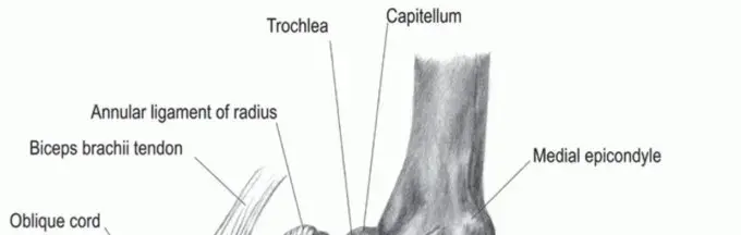 جراحة ترميم الرباط الجانبي الزندي للمرفق: دليل شامل للمرضى في اليمن والخليج