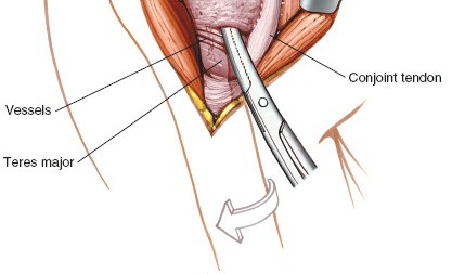 Illustration 32 for Essential Guide: Mastering Every Approach to the Shoulder