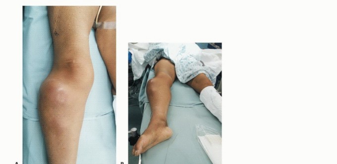 وصف طبي دقيق للمريض