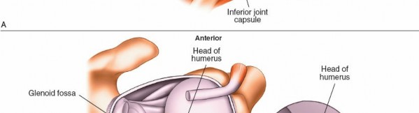 Illustration 232 for Essential Guide: Mastering Every Approach to the Shoulder