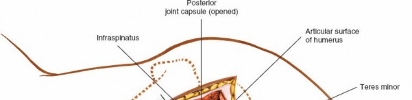 Illustration 176 for Essential Guide: Mastering Every Approach to the Shoulder