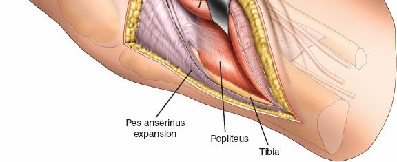 Figure 22: Rehabilitation exercise using a stationary bicycle for early range of motion.
